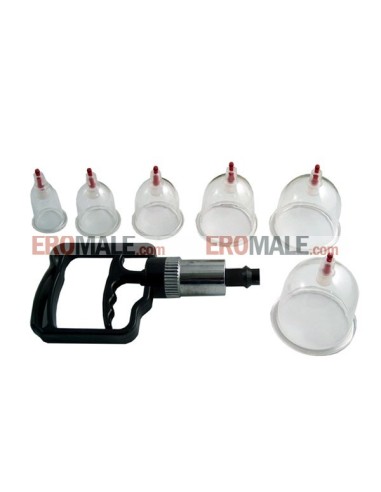 Suction Cupping Set