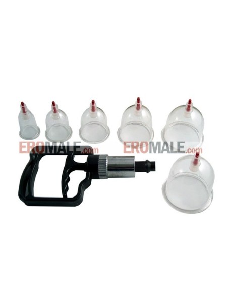 Suction Cupping Set